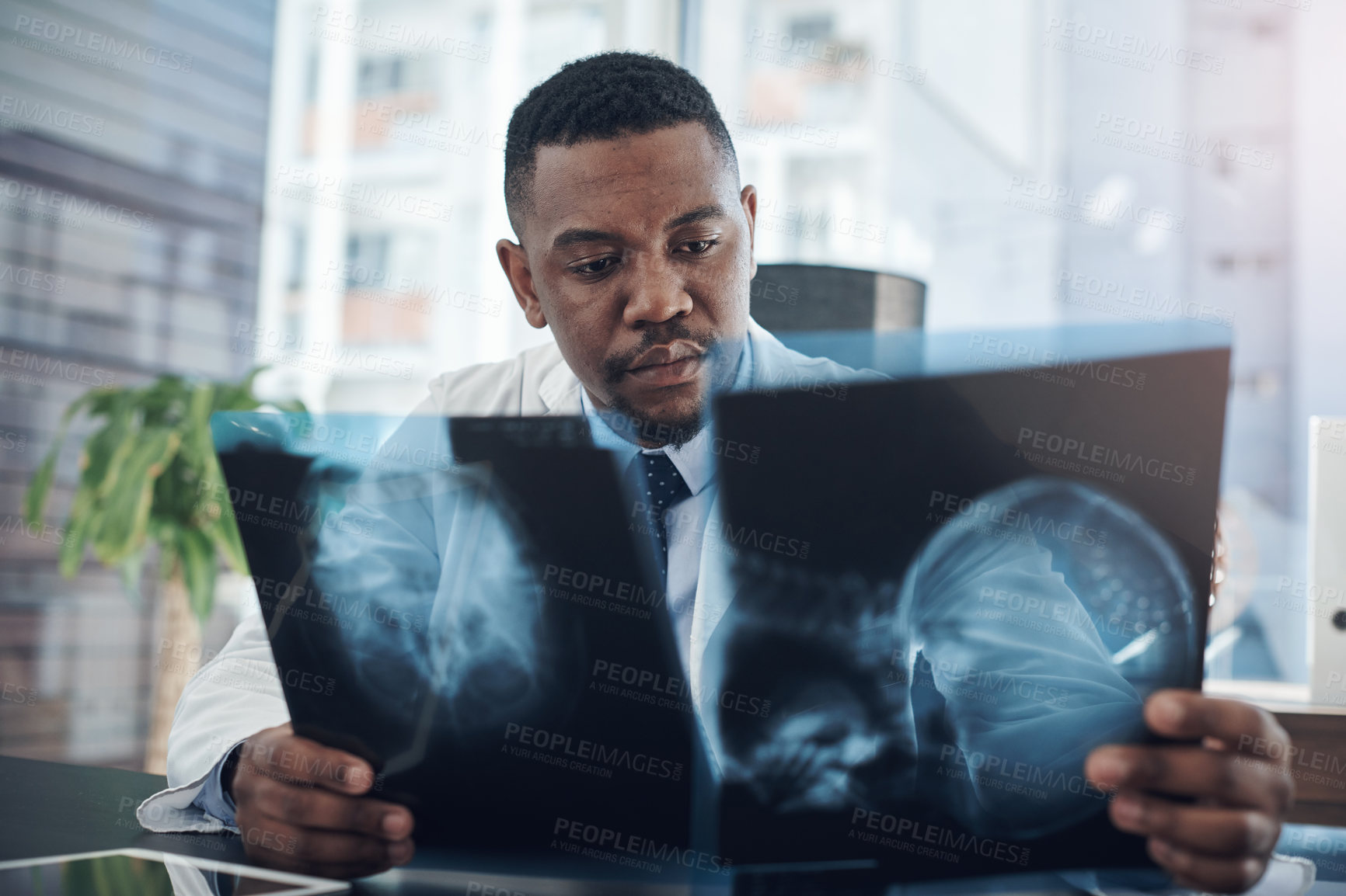 Buy stock photo Review, black man and doctor with brain scan for diagnosis, check results or ideas in hospital. Neurology, healthcare and surgeon with xray for assessment, decision or planning treatment on injury