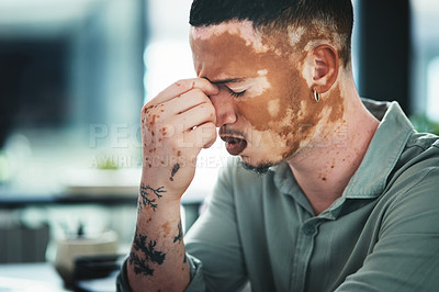 Buy stock photo Shot of a young businessman struggling with a headache in an office at work