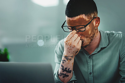 Buy stock photo Shot of a young businessman struggling with.a headache in an office at work