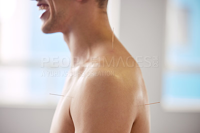 Buy stock photo Acupuncture, man and treatment of body for healthcare, healing muscle or relief from back pain. Happy, patient and physiotherapy with dry needling to relax at chiropractor or holistic care for injury