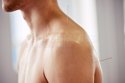 Buy stock photo Acupuncture, man and needles treatment for healthcare, healing muscle or relief from back pain. Happy, patient and physiotherapy with dry needling to relax body at chiropractor and care for injury 