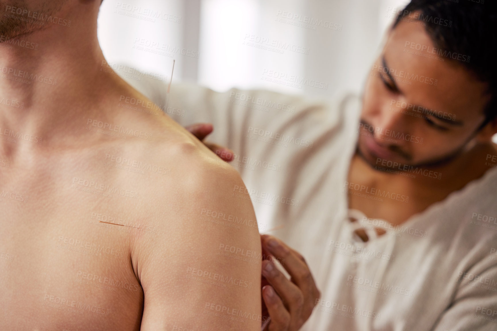 Buy stock photo Acupuncture, therapist and man in treatment for healing body muscle or relief from back pain. Helping, patient and physiotherapy with dry needling to relax at chiropractor or holistic care for injury