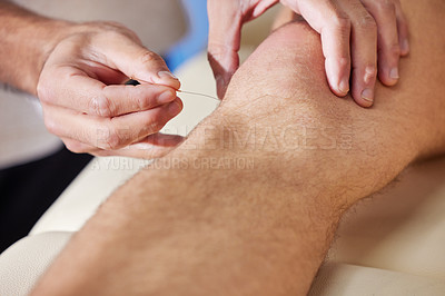Buy stock photo Shot of a acupuncturist treating a client