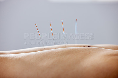 Buy stock photo Acupuncture, needles and treatment of body in healthcare, healing muscle and back pain relief. Patient, anatomy and dry needling physiotherapy to relax at chiropractor and holistic care for injury