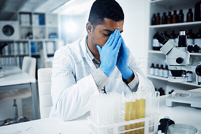 Buy stock photo Laboratory, stress and man scientist with headache working in science, frustrated or crisis. Research, fail and male healthcare expert with migraine, anxiety and mistake, burnout or depression in lab
