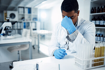 Buy stock photo Science, stress and man scientist with headache in a laboratory, frustrated and crisis. Healthcare, male and experiment fail with anxiety migraine by health expert with forensic mistake in a lab 