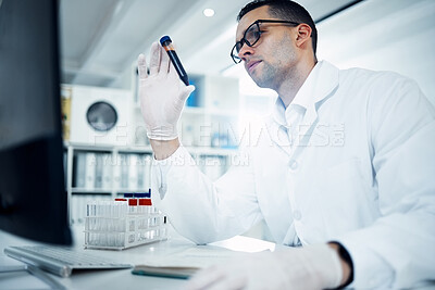 Buy stock photo Lab, microscope and scientist working in pathology career, experiment and blood sample with cultures for research study. Virus, bacteria and biotechnology innovation, professional and people