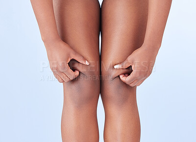 Buy stock photo Studio shot of an unrecognisable woman pulling the skin on her legs