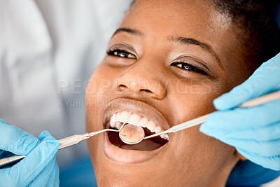 Buy stock photo Dentist, black woman teeth and patient at a clinic with medical and healthcare for cleaning. Mirror, orthodontist and African female person with wellness and dental work tool in mouth with care