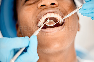 Buy stock photo Dentist, black woman mouth and patient at a clinic with medical and healthcare for teeth cleaning. Mirror, orthodontist and African female person with wellness and dental work tool with care