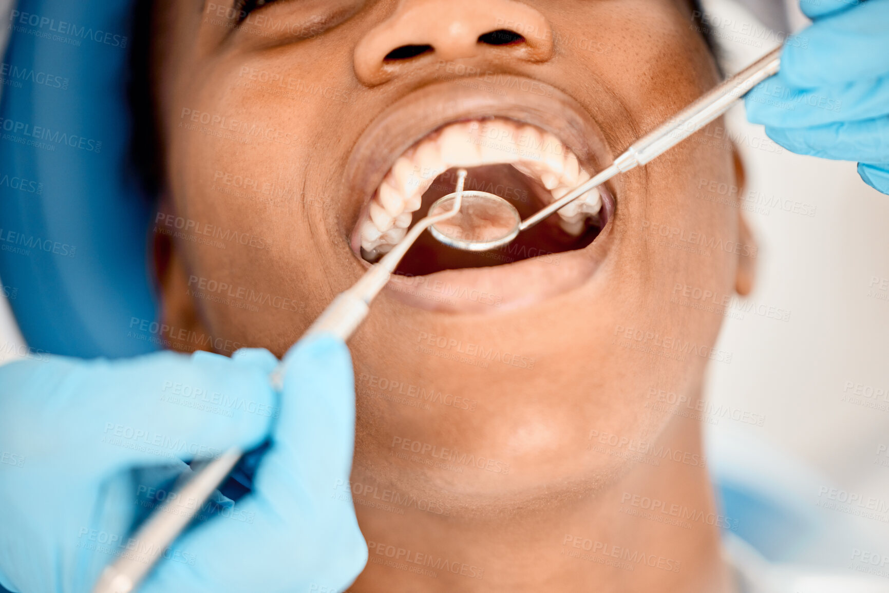 Buy stock photo Dentist, black woman mouth and patient at a clinic with medical and healthcare for teeth cleaning. Mirror, orthodontist and African female person with wellness and dental work tool with care
