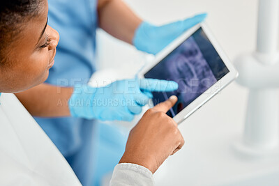 Buy stock photo Shot of a young woman looking over her dental x-rays with her doctor using a tablet