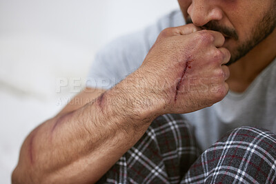 Buy stock photo Man, sad and hand wound for depression, anxiety and trauma as patient with fear, scar and paranoid. Male person, ptsd and scared with mental health, psychosis and personality disorder for breakdown