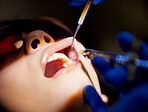 Open wide for expert dental work