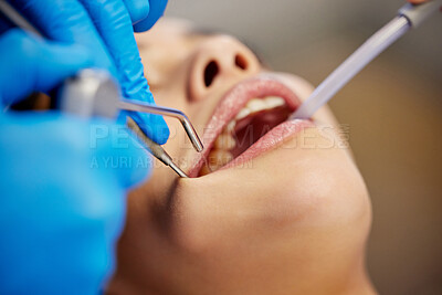 Buy stock photo Shot of a young woman having a dental procedure performed on her