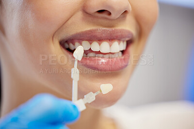 Buy stock photo Shot of an unrecognisable woman having her teeth capped at the dentist