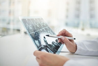 Buy stock photo Shot of a doctor analysing ultrasound scans