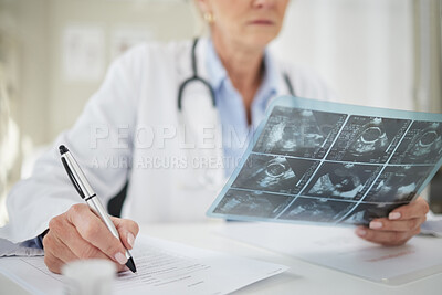 Buy stock photo Shot of a doctor analysing ultrasound scans