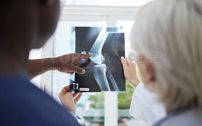Buy stock photo Shot of a mature doctor and her colleague analysing an xray