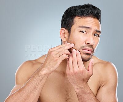 Buy stock photo Beauty, skincare and pimple with man in studio, facial and wellness on white background. Dermatology, fingers and hand for cosmetic acne for male person, dehydrated or selfcare for grooming treatment