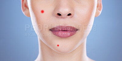 Buy stock photo Cropped shot of an unrecognisable woman posing alone against a blue background in the studio with acne spots