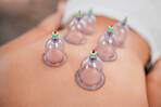 Spa, healthy body and cupping therapy for stress, pain treatment or wellness. Luxury, cup suction or heat to help with pain, deep tissue massage or enhance circulation for health, healing or recovery