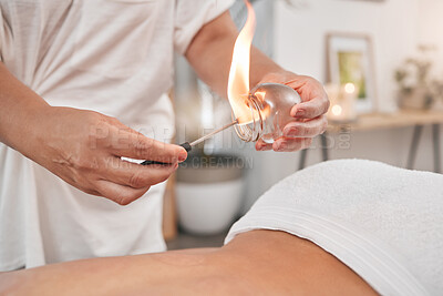 Buy stock photo Spa, cupping therapy and flame to relax, stress and tension release. Alternative medicine, wellness and suction cup for relief treatment, healing back pain and help with blood flow and inflammation.