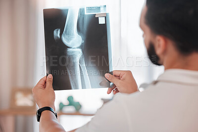 Buy stock photo Health, x ray and physiotherapy, man physiotherapist check medical results from injury, broken bone and healthcare. Physio, wellness and medicine, rehabilitation in health care and xray scan.