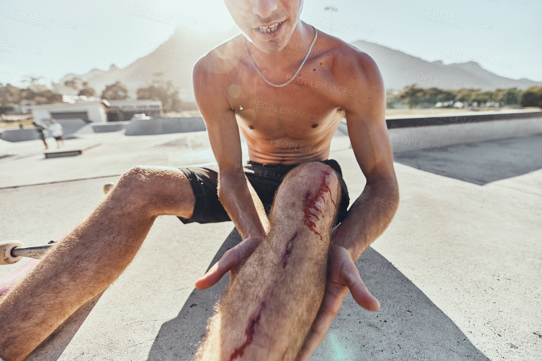Buy stock photo Skater, knee pain and man with blood on injury after a skateboard accident in sports skate park in summer. First aid, emergency and person with leg wound or bruise for falling in training or exercise