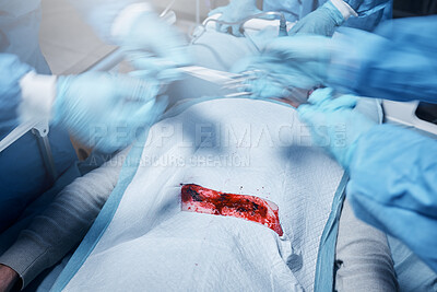 Buy stock photo Hands, blood and operation with a team of doctors at work during surgery with equipment or a tool in a hospital. Doctor, nurse and collaboration with a medicine professional group saving a life