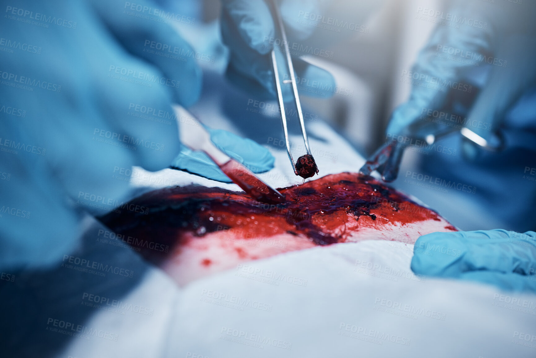 Buy stock photo Hands, blood and operation with a team of doctors at work during surgery with equipment or a tool in a hospital. Doctor, nurse and collaboration with a medicine professional group saving a life