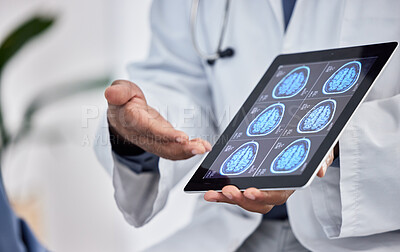 Buy stock photo Neurology, healthcare and doctor with tablet in hands for brain research, test results or cancer innovation in hospital or clinic consultation. Medical worker on digital technology for MRI assessment