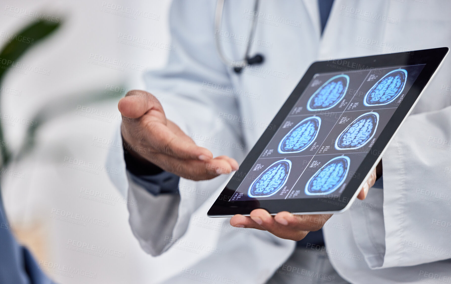 Buy stock photo Neurology, healthcare and doctor with tablet in hands for brain research, test results or cancer innovation in hospital or clinic consultation. Medical worker on digital technology for MRI assessment