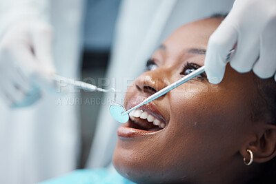 Buy stock photo Black woman, mouth and face with dentist, tools in hands and dental, teeth check for healthcare with tooth decay. Tooth surgery, orthodontics and smile, teeth whitening, closeup and Invisalign