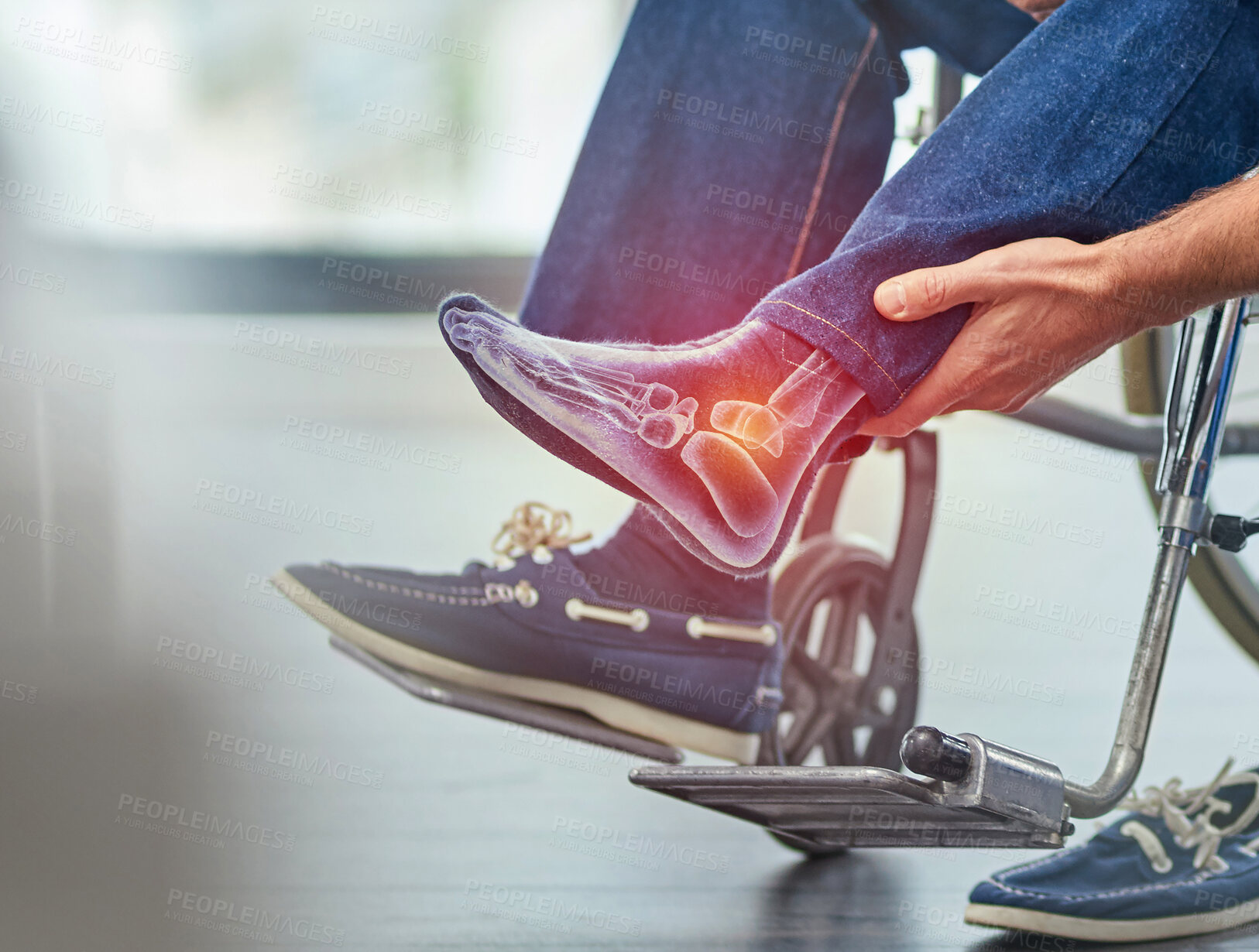 Buy stock photo Closeup, man in wheelchair and foot injury with pain, inflammation and accident with torn muscle. Zoom, male and guy in pushchair, highlighted for strained area and disability with broken ankle