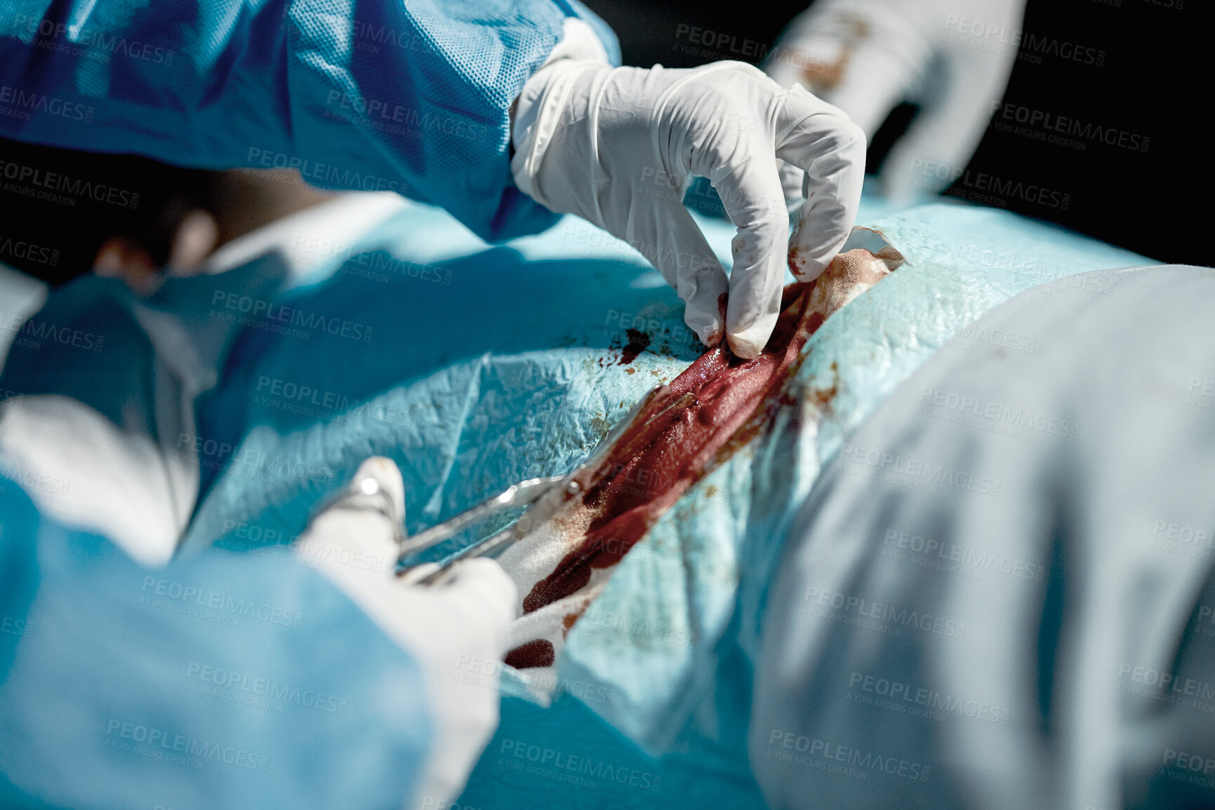 Buy stock photo Surgeon hands, cut blood and doctor hand with medical surgeon scissors for hospital and clinic emergency. Health service, doctors and wellness care of healthcare worker working on patient with tools