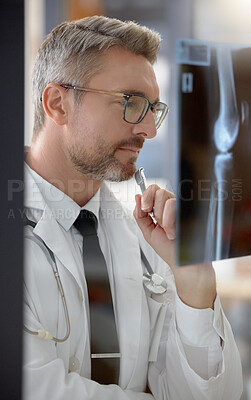 Buy stock photo Analysis, healthcare and doctor looking at an x ray for research, body problem and medical results. Medicine, expert and man working in radiology examining a scan for a bone fracture at a hospital