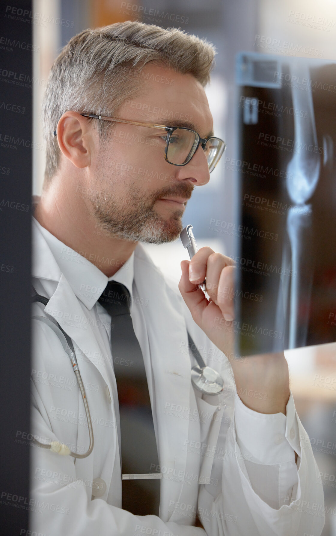 Buy stock photo Analysis, healthcare and doctor looking at an x ray for research, body problem and medical results. Medicine, expert and man working in radiology examining a scan for a bone fracture at a hospital