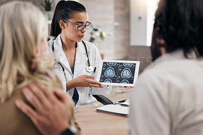 Buy stock photo Neurology, results on tablet and doctor with couple, mri brain scan or x ray diagnosis for cancer. Consulting, man and woman in doctors office with anxiety on health problem, patient data in hospital