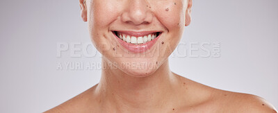 Buy stock photo Face smile, dental and teeth of woman in studio isolated on a gray background. Skincare makeup, cosmetics and lips, mouth and oral hygiene of happy female model with veneers, invisalign and wellness.