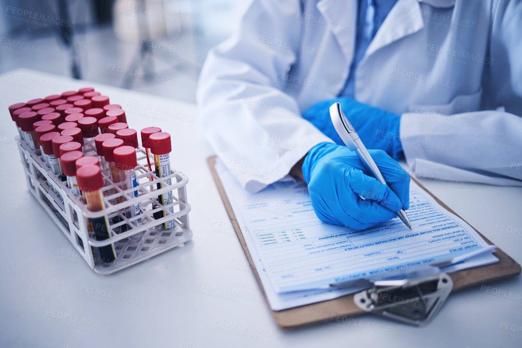 Buy stock photo Blood test, medicine documents and hands in laboratory for healthcare planning, science review or checklist. Scientist, report and writing medical results of dna investigation, paperwork and research