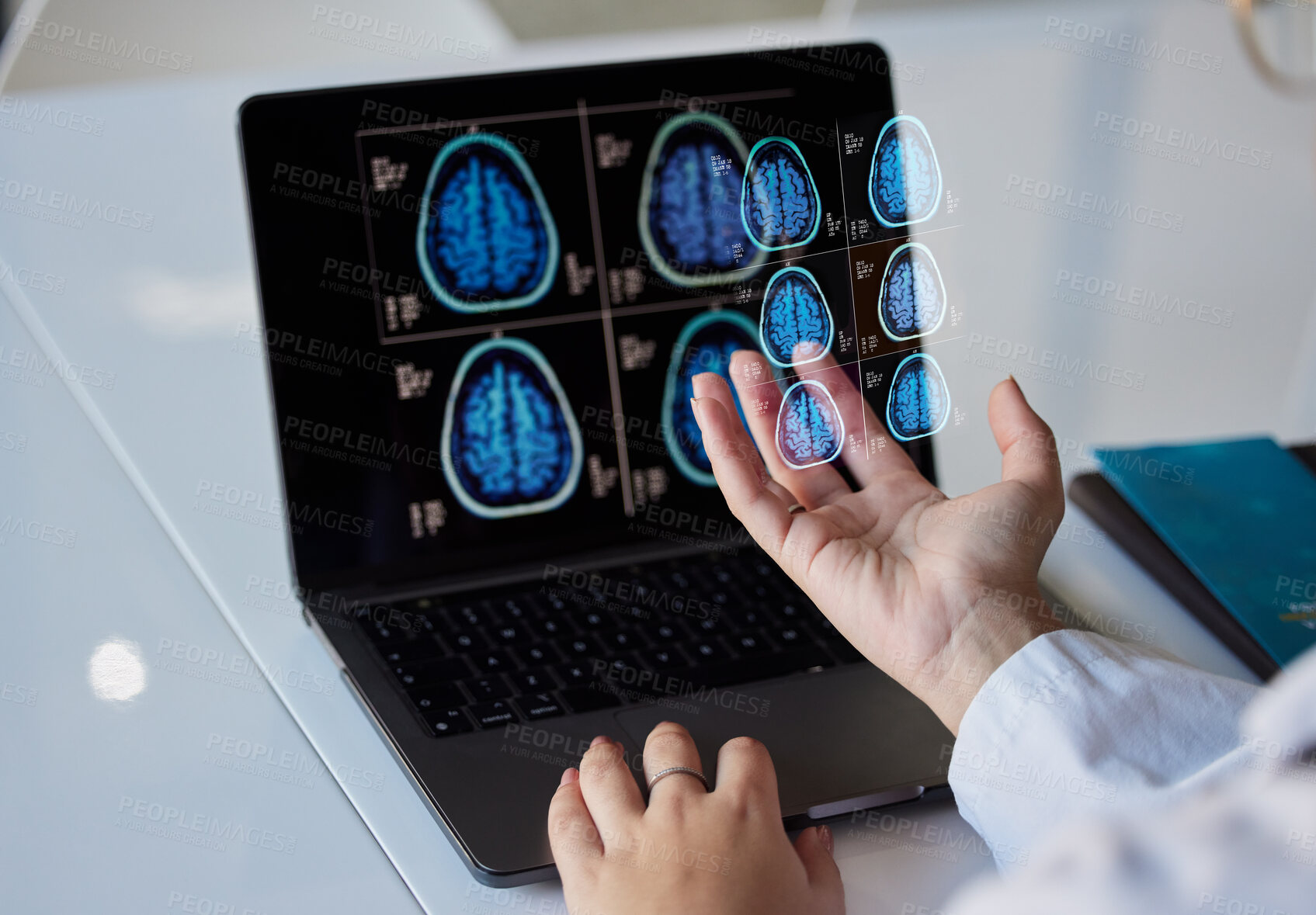 Buy stock photo Brain x ray graphic, clinic results and doctor hands with digital report about neurology work. Anatomy, xray and assessment data with a healthcare employee holding mri test information in a hospital