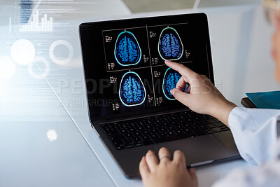 Buy stock photo Brain x ray, computer results and doctor hands with digital report graphic about neurology. Anatomy, xray and assessment data with a healthcare employee with mri test information in a hospital