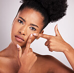 Portrait, black woman and squeeze face for pimple in studio, background and hands press acne scar. Female model check facial, spot and blackhead for breakout, oily skincare and bad beauty problem 