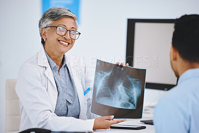 Buy stock photo Happy, showing x ray and doctor with a man for medical advice, help and conversation. Radiology, healthcare and a mature woman holding a picture to show a patient results, research and hospital scan