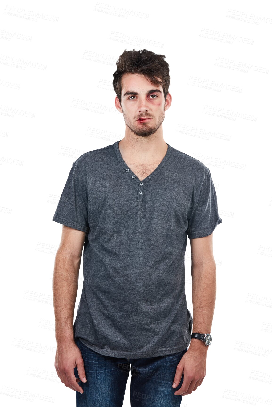 Buy stock photo Portrait, injury or man with bruise, blood on face after fighting isolated on transparent png background. Facial wounds or serious male standing after dangerous domestic abuse attack, crisis or pain