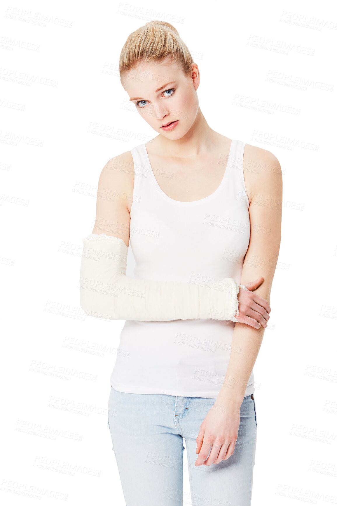 Buy stock photo Woman with injury, portrait and cast on arm with accident or medical emergency isolated on transparent or png background. Health insurance, first aid and sad injured female person in healthcare pain