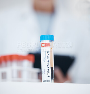 Buy stock photo Blood test, sample of virus and science in laboratory, research and studying monkeypox, infection and viral disease. Medical study, tube and analysis of pathology, biology and immunity in dna
