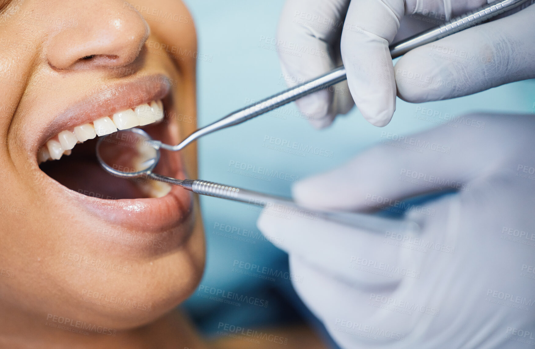 Buy stock photo Dentist, healthcare and hands, patient mouth and medical tools, surgery and dental health. Tooth decay, orthodontics procedure and people in clinic for oral care, metal instrument and gingivitis 