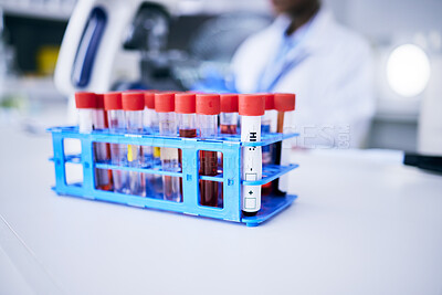 Buy stock photo Medical, research and vials with blood test, science and breakthrough with discovery, experiment and project. Tube, healthcare and laboratory equipment with scientific innovation and chemical liquid